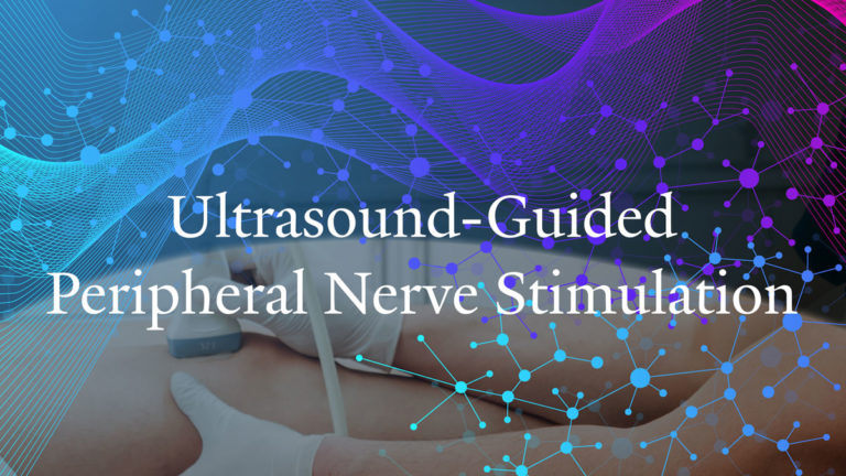Video: Ultrasound-Guided Peripheral Nerve Stimulation for Postoperative ...